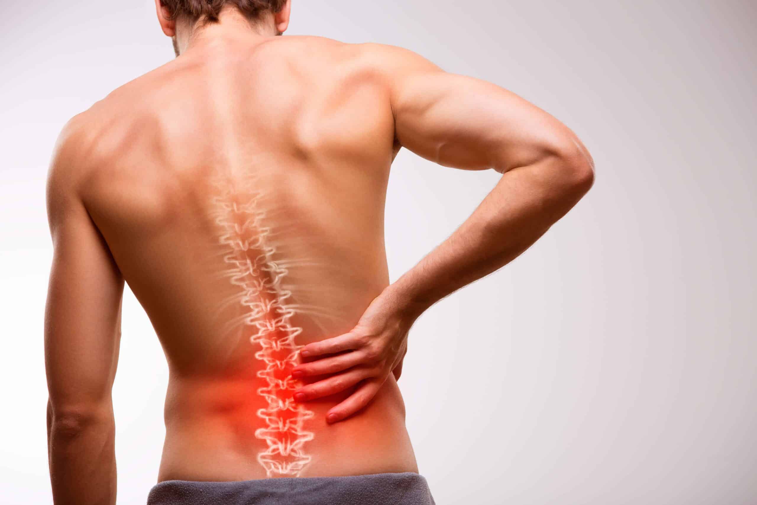 CBD Cream for Sciatica